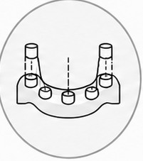 Schematische Darstellung des Backward Planning